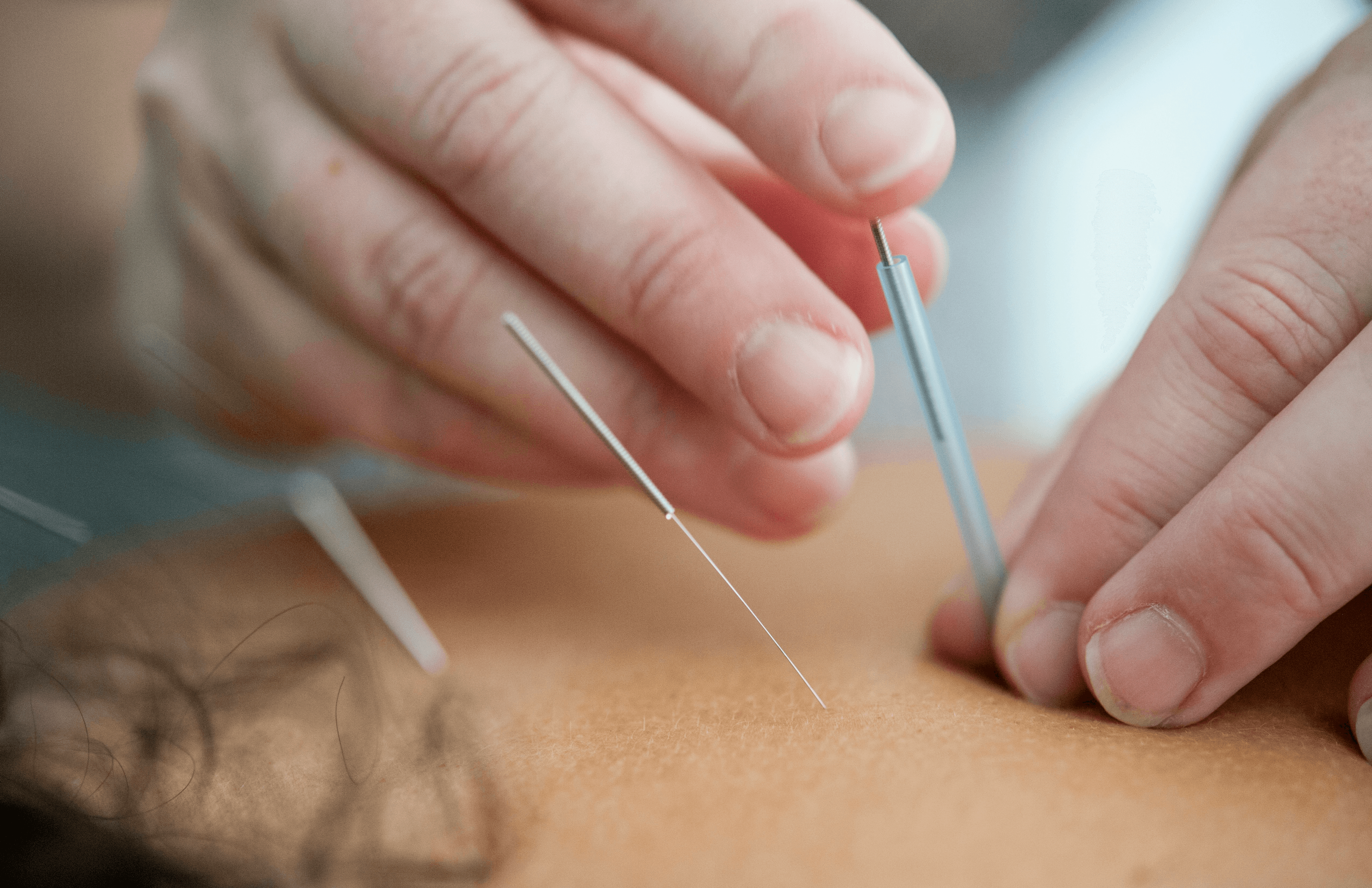 TCM Rare Disease Diagnostics & Management